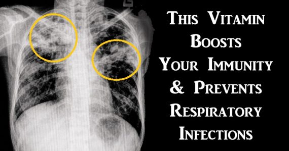Αυτή η βιταμίνη ενισχύει το ανοσοποιητικό μας σύστημα και αποτρέπει από λοιμώξεις του αναπνευστικού