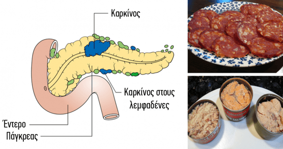 Αυτές τις τροφές πρέπει να αποφεύγετε να βάζετε στο στόμα σας, καθώς έχει αποδειχθεί οτι προκαλούν καρκίνο!