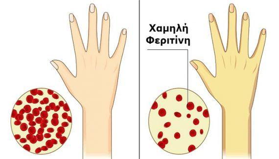 Τι είναι η φερριτίνη στο αίμα και με ποιες τροφές θα την αυξήσουμε;