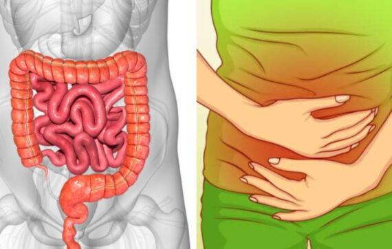 Πόνος στη κοιλιά, φούσκωμα και δυσκοιλιότητα: Τα χειρότερα τρόφιμα που σκοτώνουν το έντερο