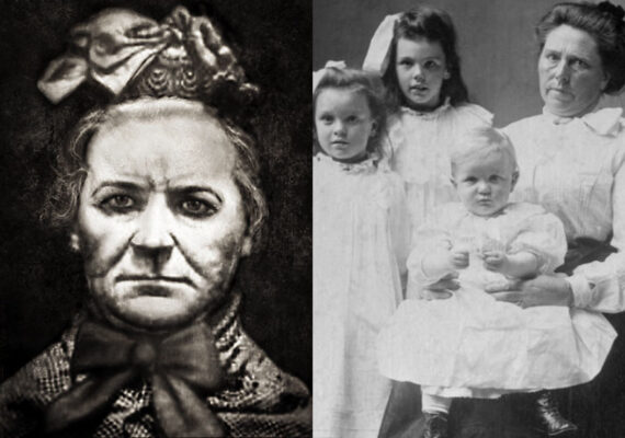 Amelia Dyer: Ο θηλυκός Ηρώδης – Η πιο αιμοσταγής κατά συρροή δολοφόνος που σκότωσε πάνω από 400 μωρά