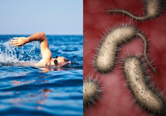 Vibrio vulnificus: