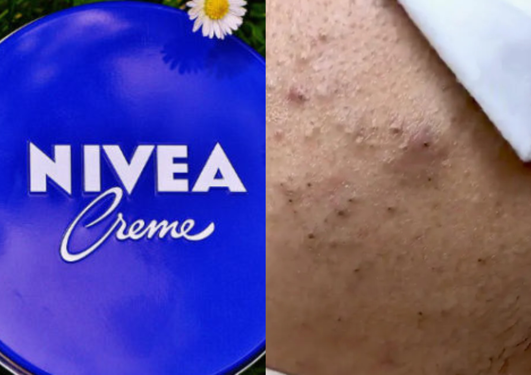 Μάσκα προσώπου με NIVEA και ρυζάλευρο για μαύρα στίγματα και βαθιά ενυδάτωση (στο εξώφυλλο η δευτερη φωτο ειναι κομπλε η πρωτη θελει τη νιβεα)